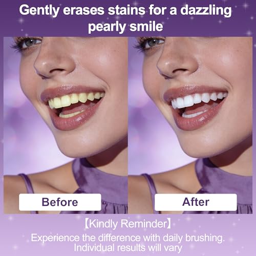 7-Pro Whitening Toothpaste with 7 Probiotics, Advanced Stain Removal Formula for Gum Health, Purple Burst Beads for Fresh Breath, Fluoride-Free & Enamel Safe (3 PCS)