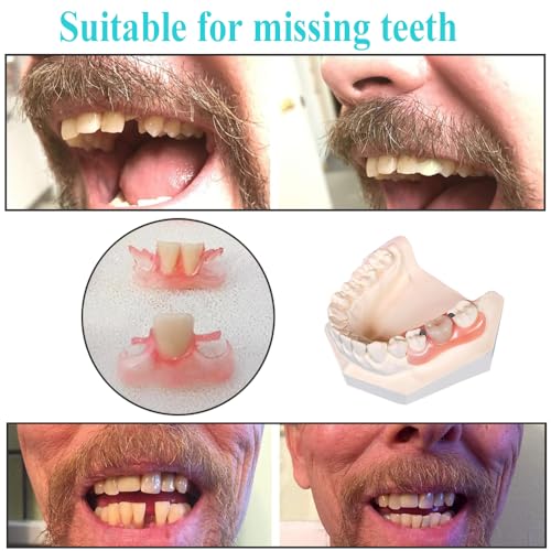 Dentures Fake Teeth DIY Kit Easy and Convenient DIY Fake Teeth Repair Missing Teeth or DIY Full Denture Kit Fake Teeth Top and Bottom Temporary Fake Teeth
