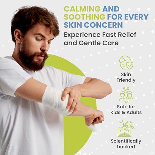 Calendula Burn Cream, Healing Ointment for Skin & Wound Care, 1 oz