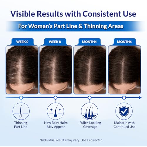 Minoxidil for Men and Women Extra Strength: Minoxidil 5% Topical Solution for Hair Regrowth Treatment for Hair Loss & Thinning Hair - Liquid Formula with Dropper Applicator