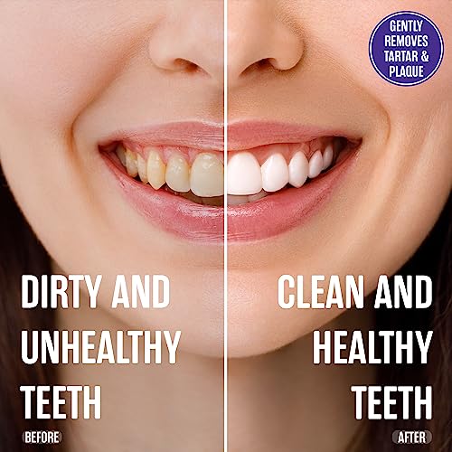 SprinJene Fluoride Free Toothpaste - Patented Natural Toothpaste with Black Seed Oil & Zinc - Made in the USA - Vegan Non Fluoride for Fresh Breath Preservative Free (4 Pack) Pack of 4 Sensitivity - Fluoride Free