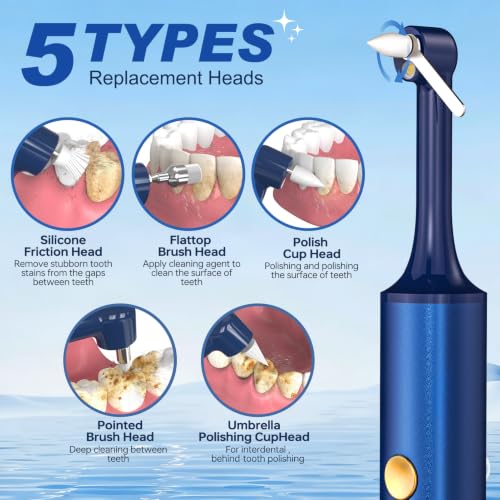 Tooth Polisher, Tooth Whitening Kit for Teeth Cleaning and Whitening Blue 1 Count (Pack of 1)
