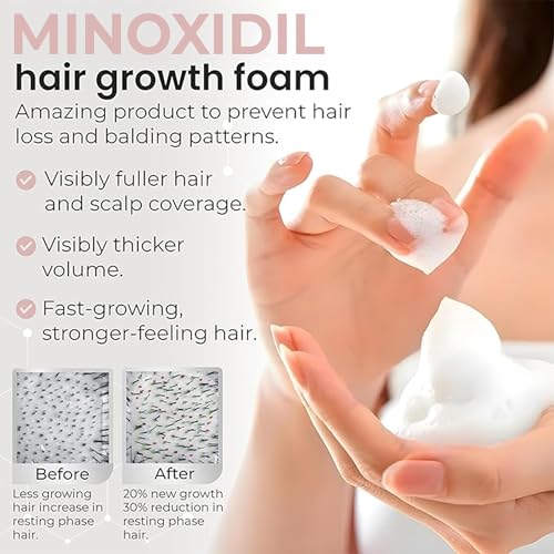 Minoxidil for Women 5% Minoxidil Hair Regrowth Treatment Topical Foam