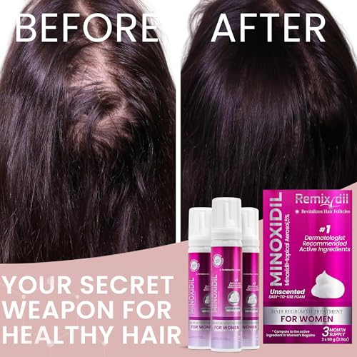 Minoxidil for Women 5% Minoxidil Hair Regrowth Treatment Topical Foam