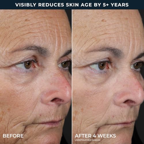 RoC Retinol Correxion Line Smoothing 2-Step Peel Pads - 20 Treatments 20 Count (Pack of 1)