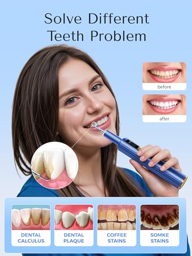 Plaque Remover for Teeth - 42kHz Ultrasonic Tartar Remover with Smart Gum Safety Sensor, 10-Piece Kit (4 Heads + 6 Dentist Tools), LED Light, USB-C Rechargeable, IPX6 Waterproof for Home & Travel Blue