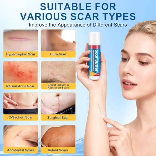 Scar Butter Stick with Vitamin E, Cocoa Butter & Coconut Oil, Nourishing Skin Care Cream for Face, Body & Hands,For All Skin Types -1Pack 0.7 Fl Oz (Pack of 1)