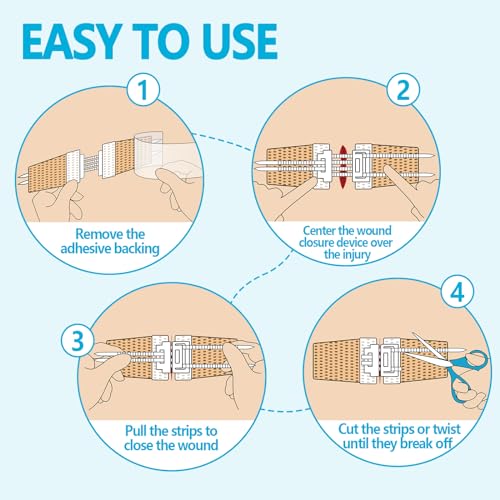 Wound Closure Device 4 Pcs - Zip Sutures & Butterfly Bandage | Stitchless Wound Repair, Rapid Hemostasis for Hiking, Camping, Wilderness Survival | Outdoor First Aid Essentials Non-woven 4 PCS