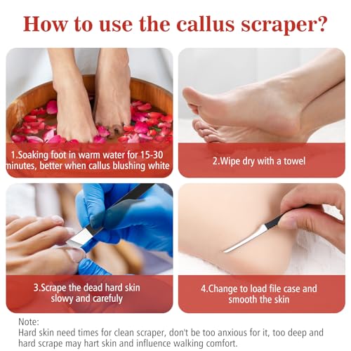 cobee 6 Pcs Ingrown Toenail Removal Kit, Callus Shaver Ingrown Toenail Tool with A Storage Box, Foot Callus Remover Tool Pedicure Knife for Foot Care Dead Skin Corn File Rasp