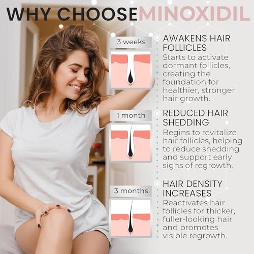 Minoxidil for Women 5% Minoxidil Hair Regrowth Treatment Topical Foam