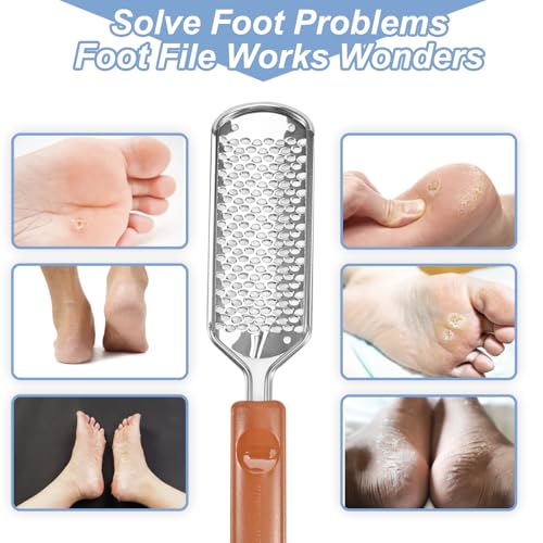 Professional Foot Scrubber Dead Skin Remover, Pedicure Foot File Callus Removal, Heel Scraper for Cracked Heels, Microplane Cheese Grater for Feet, Foot Rasp for Hard Skin(T1) T1