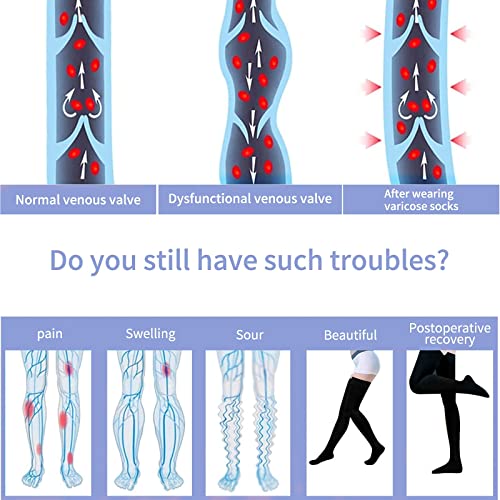 Compression Stockings for Women & Men, 15-20mmHg Thigh High Compression Socks,Closed Toe Medical Compression Socks with Silicone Dot Band-Best Support for Running Nursing Sports Varicose Veins Black X-Large