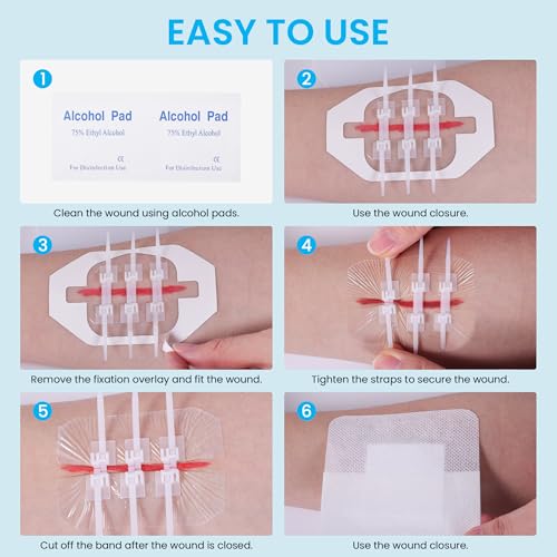 Wound Closure Strips, Zip Stitch Laceration Closure Kit, 6PCS 3-Straps