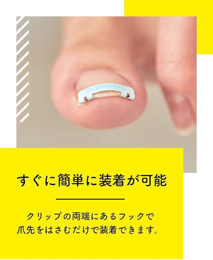 [General Medical Devices] Curled Nail Correction Doctor Shawl Wrap Nail Clip, Large Size x 2 -  Australia