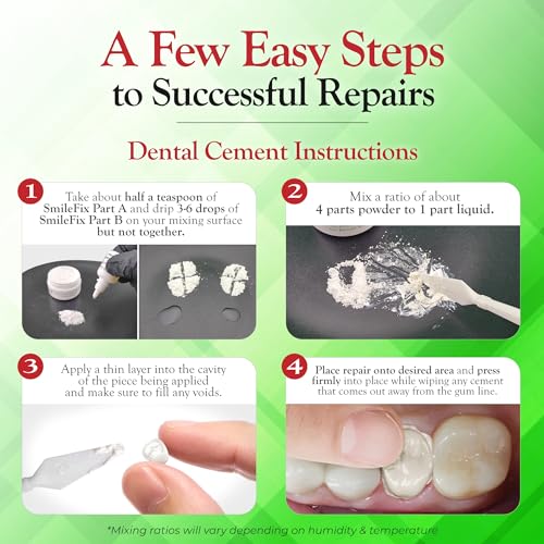 SmileFix Dental Cement & Filling Repair Kit Crowns, Bridges & Fillings