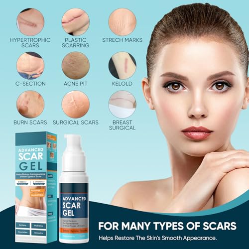 Scar Gel, Scar Cream, Advance Scar Gel for Surgical Scars for Surgical Scars, C-Section, Stretch Marks, Acne, Injury, Burns, Keloids, Old and New Scars,1.7oz