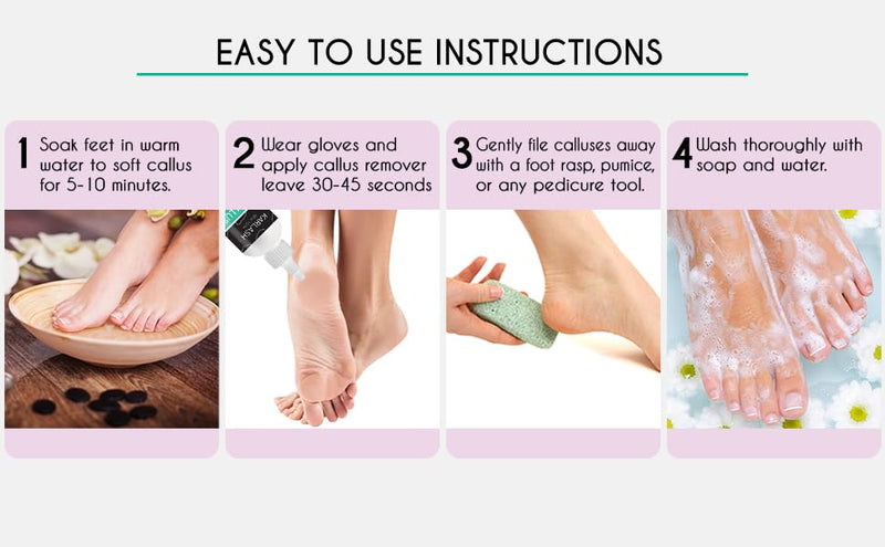 Karlash Callus Remover Gel for Feet and Foot Pumice Stone Scrubber Kit Remove Hard Skins Heels and Tough Callouses from feet Quickly and Effortless 4 oz (4 Ounce) 4 Ounce - BeesActive Australia
