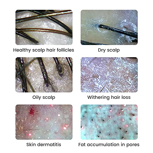 Wireless Skin Analyzer Dermatoscope UV 1000X Magnifier Digital Microscope
