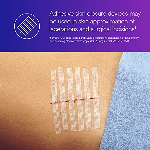 3M™ Steri-Strip™ Reinforced Adhesive Skin Closures, R1547, 1/2 in x 4 in (12 mm x 100 mm), 50 Bag/Carton, 4 Carton/Case