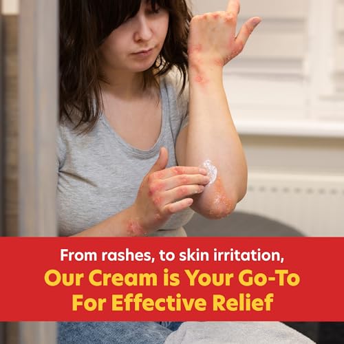 Berkley Jensen Maximum Strength Anti-Itch Cream (4 oz.), with Calming Aloe Vera, 1% Hydrocortisone Itch Relief for Eczema, Psoriasis, Bug Bites, Poison Ivy, Oak and Sumac, 2 oz. Tube (Pack of 2)