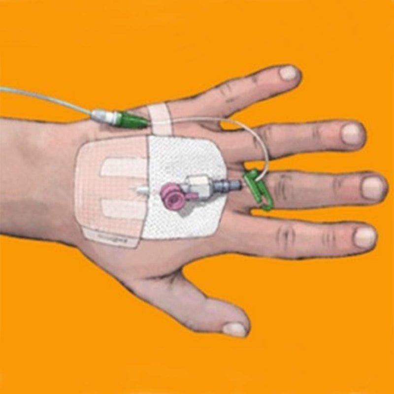 4008 Dressing IV3000 Wound LF Sterile Transp Film 4x4-3/4" 50 Per Pack Part No. 4008 by- Smith & Nephew Wound Care