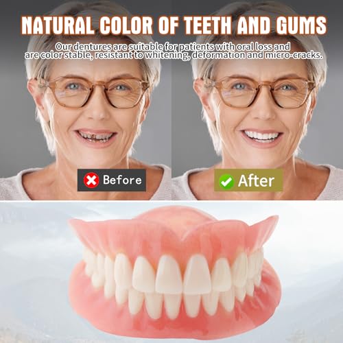 DIY Denture kit Convenient and Easy DIY dentures kit at Home Complete Make Your own dentures Kits for top and Bottom of Temporary Repair Missing Teeth red 01