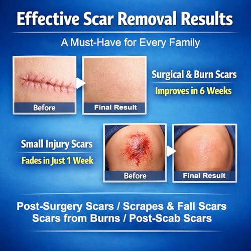 Morovan silicone scar removal Gel: Scar cream for Body and face Effectively minimizes the appearance of Scars from Stretch Marks Surgical Scar Keloids Acne Burns and Other, New scar 6 weeks