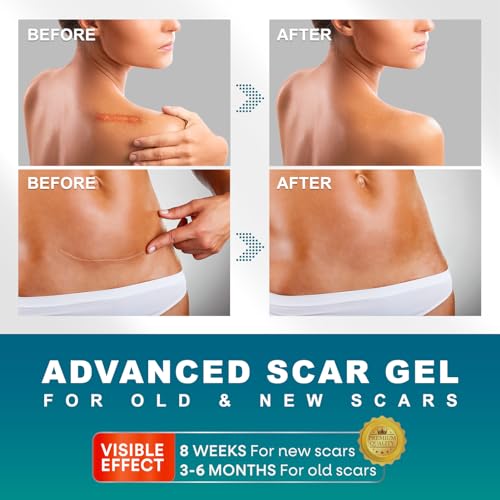Scar Gel, Scar Cream, Advanced Scar Gel for Surgical Scars, Scar Cream for Surgical Scars, C-Section, Tummy Tuck, and Keloid 50g