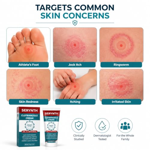 Antifungal Cream Clotrimazole 1%, Athlete's Foot & Ringworm Care, 30g
