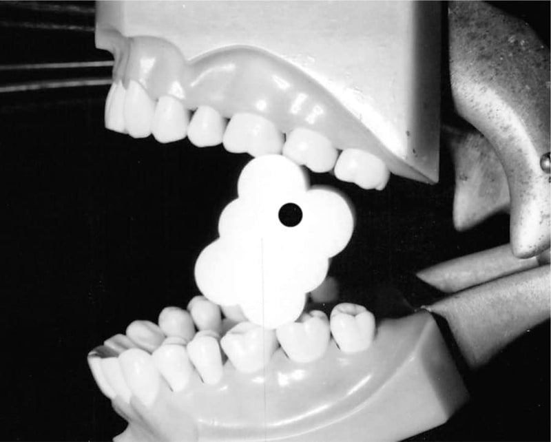 EZ Prop ­® Disposable Mouth Prop - 100 Count