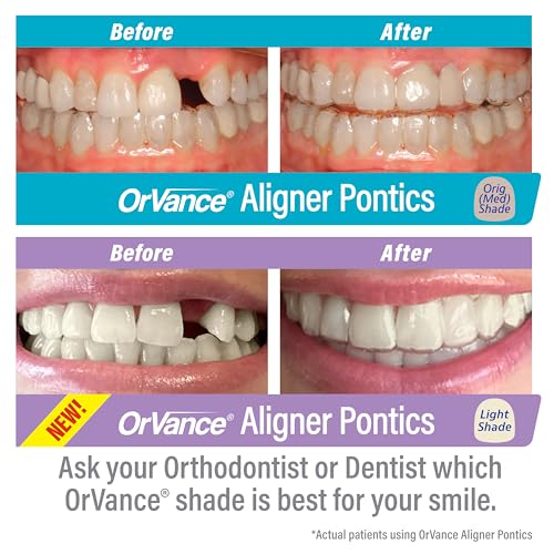 ORVANCE Aligner Pontics - Light Shade (32 Count) | Fills The Space of Missing Teeth in Clear aligners and Retainer Trays