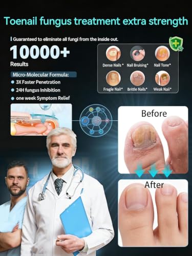 2026 Upgrade Toenail Fungus Treatment【Maximum Undecylenic Acid & Tea Tree】 White-3 Pack