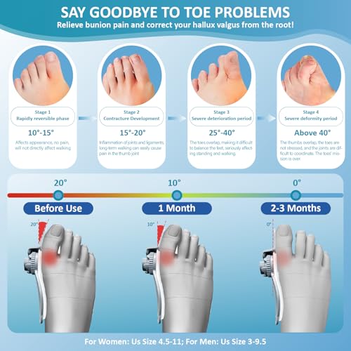 Bunion Corrector for Women & Men with Adjustable Knob, Complete Orthopedic Splint & Toe Separator Kit for Hallux Valgus Pain Relief, Day & Night Use on Left/Right Feet 1