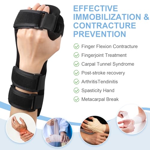 Resting Hand Splint Left & Right – Adjustable Night Wrist Brace with Finger Separators for Carpal Tunnel, Arthritis, Tendonitis, Post-Injury Recovery – Breathable Hand Support for Straightening Fingers (Large Left) Large Left