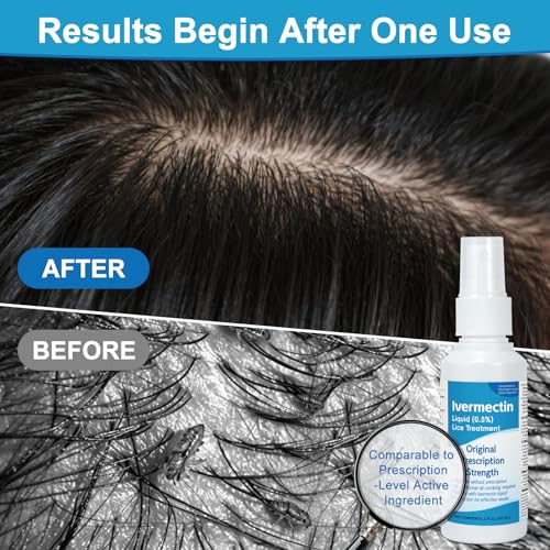 Liquid for Adults (2 Fl Oz), Lightweight Hair, Fast-Apply Topical Liquid Formula, for Head Lice & Egg Care