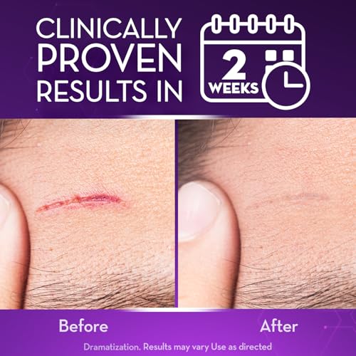 Cicatricure Advanced Scar Gel, Proven Results in 2 Weeks, 2 oz (56 g) 2 Ounce (Pack of 1)