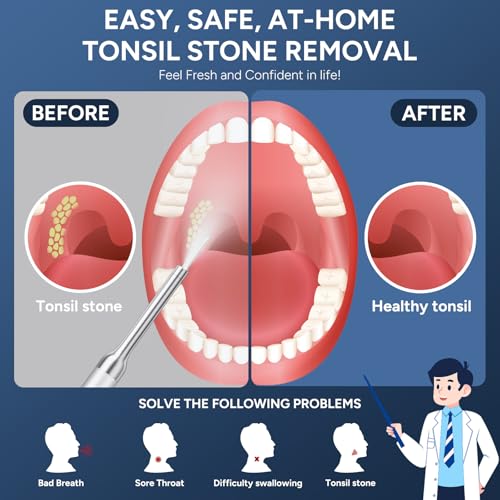 Tonsil Stone Remover with Camera - Upgraded Visual Tonsil Stone Removal Kit White
