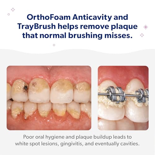 EverSmile Braces Care Bundle for Kids: OrthoFoam Anticavity (50ml) + TrayBrush U-Shaped Toothbrush – Deeply Cleans All Your Teeth & Gums at Once, Even Under Metal & Ceramic Braces, Brackets & Wires Child Anticavity