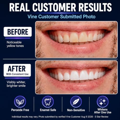 Purple Teeth Whitening Strips | 28 Whitening Strips | Enamel Safe,Sensitive