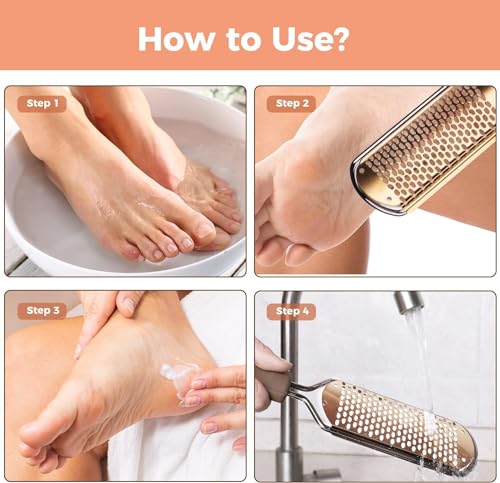 Foot File Foot Scrubber Pedicure - Callus Remover for Feet Easkep Professional Grater Rasp Foot Scraper Corns Callous Removers Cracked Dead Skin Remover for Dry and Wet Feet (Golden) Golden