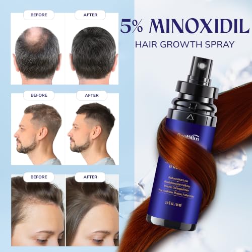 5% Minoxidil Hair Growth for Men and Women: 3-Pack RootStim Extra Strength Minoxidil Beard Regrowth Treatment with Rosemary for Thinning Hair Regrowth and Fuller Hair 180 ML 2.02 Fl Oz (Pack of 3)