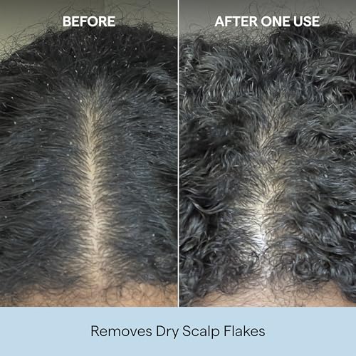 Briogeo Scalp Revival Charcoal + Coconut Oil Micro-Exfoliating Shampoo | Sulfate-Free Scalp Scrub for Dry, Itchy, or Oily Scalp | Detoxifying & Hydrating | Vegan & Cruelty Free 2 Fl Oz