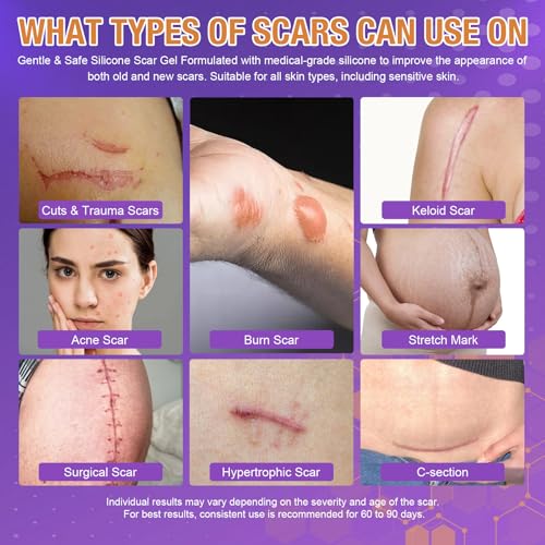 Advanced Scar Gel – Silicone Scar Gel for Keloid Bump Removal, Post-Surgery Scars, Acne Scars, Burn Marks & Stretch Marks – Scar Treatment for Old & New Scars – 1.2oz / 35g 1.2 Ounce (35g)