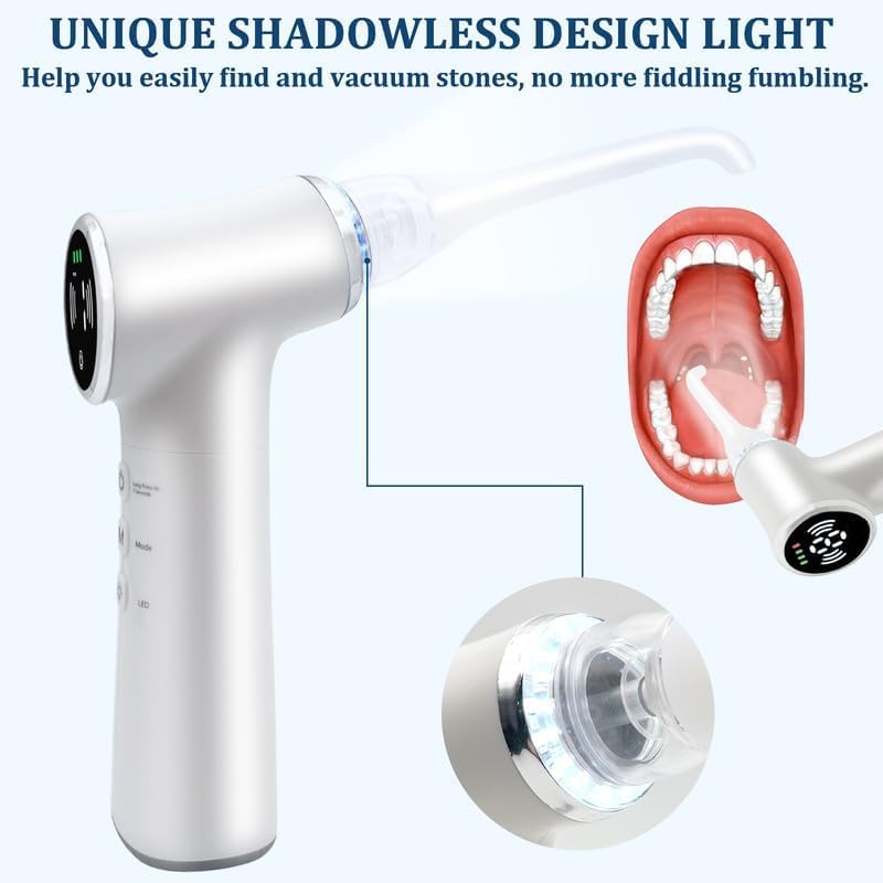 Upgraded Tonsil Stone Remover Tool, Upgraded Electric Tonsil Stone Removal Kit - with Built-in LED Light & 6-Level Suction for Bad Breath Prevention, Oral Suction Device for Stone Removal(off white) Ivory