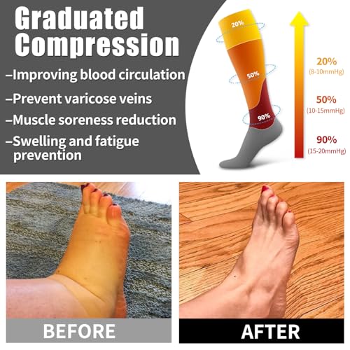 6 Pack Copper Compression Socks for Women and Men Circulation-Best Support for Medical,Running,Nursing,Athletic Large-X-Large D-assorted1