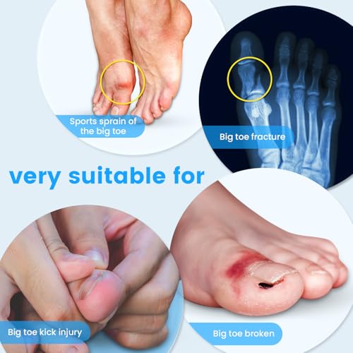 Big Toe Splint for Women & Men, Broken Big Toe Support Brace for Fracture Fixation,Sports Sprains,Injuries, Adjustable Big Toe Protector with 2 Stainless Steel Plates for Day & Night - Left (Blue-Black) (Blue-Black)