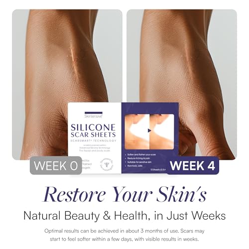Silicone Scar Sheets