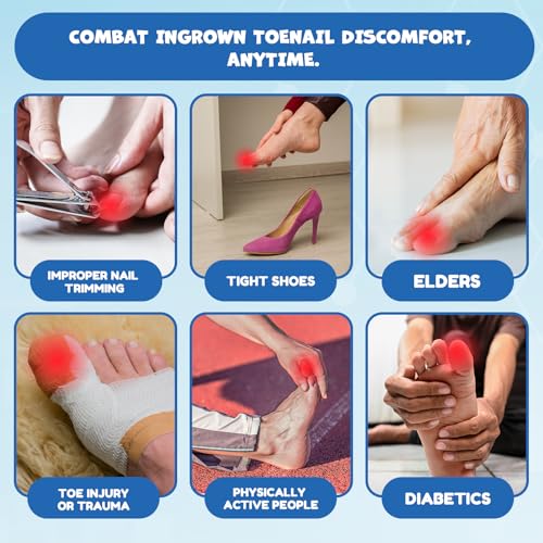 Ingrown Toenail Corrector Kit - Professional Home Pedicure Care for Toenail - Includes Toenail Correction Strips for Ingrown Toenail Relief Removal