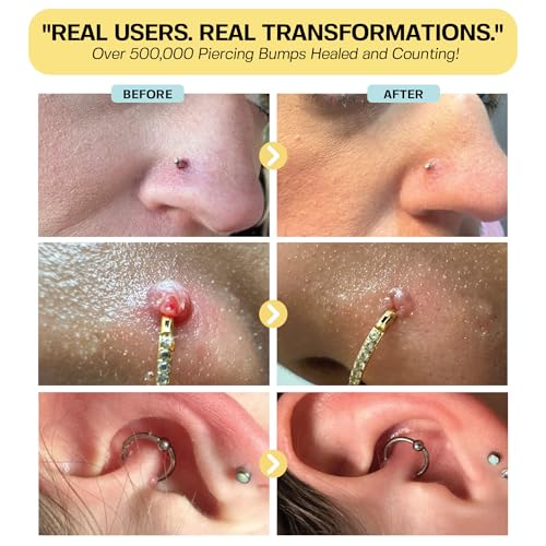 BASE LABORATORIES Piercing Bump Solution & Keloid Bump Removal | Soothing Piercing Aftercare for Piercing Bumps & Keloid Scar Removal | Ear & Nose Keloid Bumps Piercing Aftercare Solution Oil | 0.5 oz 0.5 Fl Oz (Pack of 1)