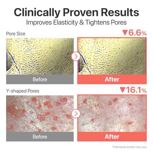 numbuzin No.3 Super Glowing Essence Toner, Fermented Toner for Skin Glow & Texture, Bifida, Niacinamide, Hydrating, Radiance-Boosting Essence, Pore Reset, 6.76 fl oz (200ml) 6.76 Fl Oz (Pack of 1)